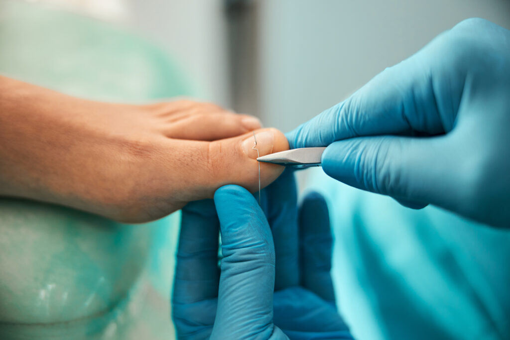 Une esthéticienne qui porte un gant et coupe des ongles d'une personne