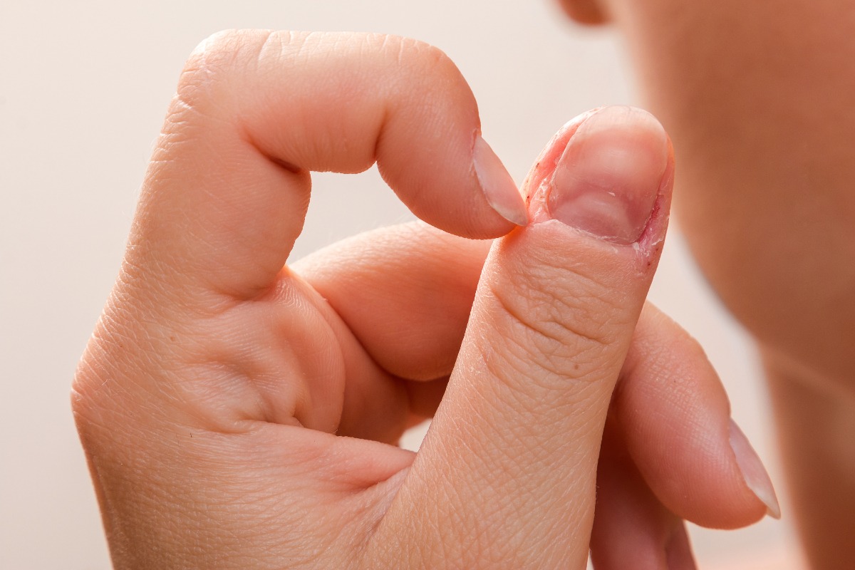 Main d'une personne avec un ongle de pouce strié