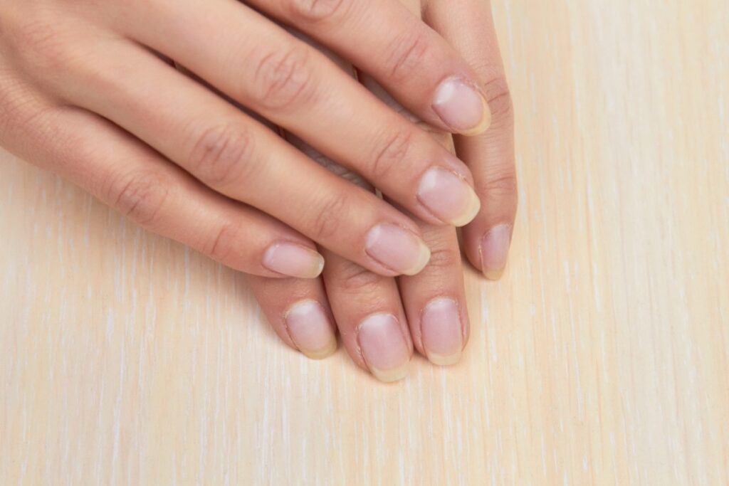Mains sur la table avec des ongles qui jaunissent