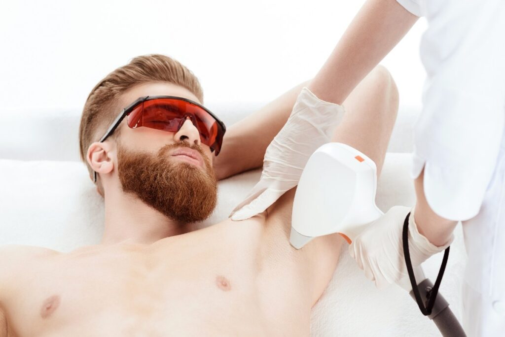 Epilation laser pour l'aisselle d'un homme